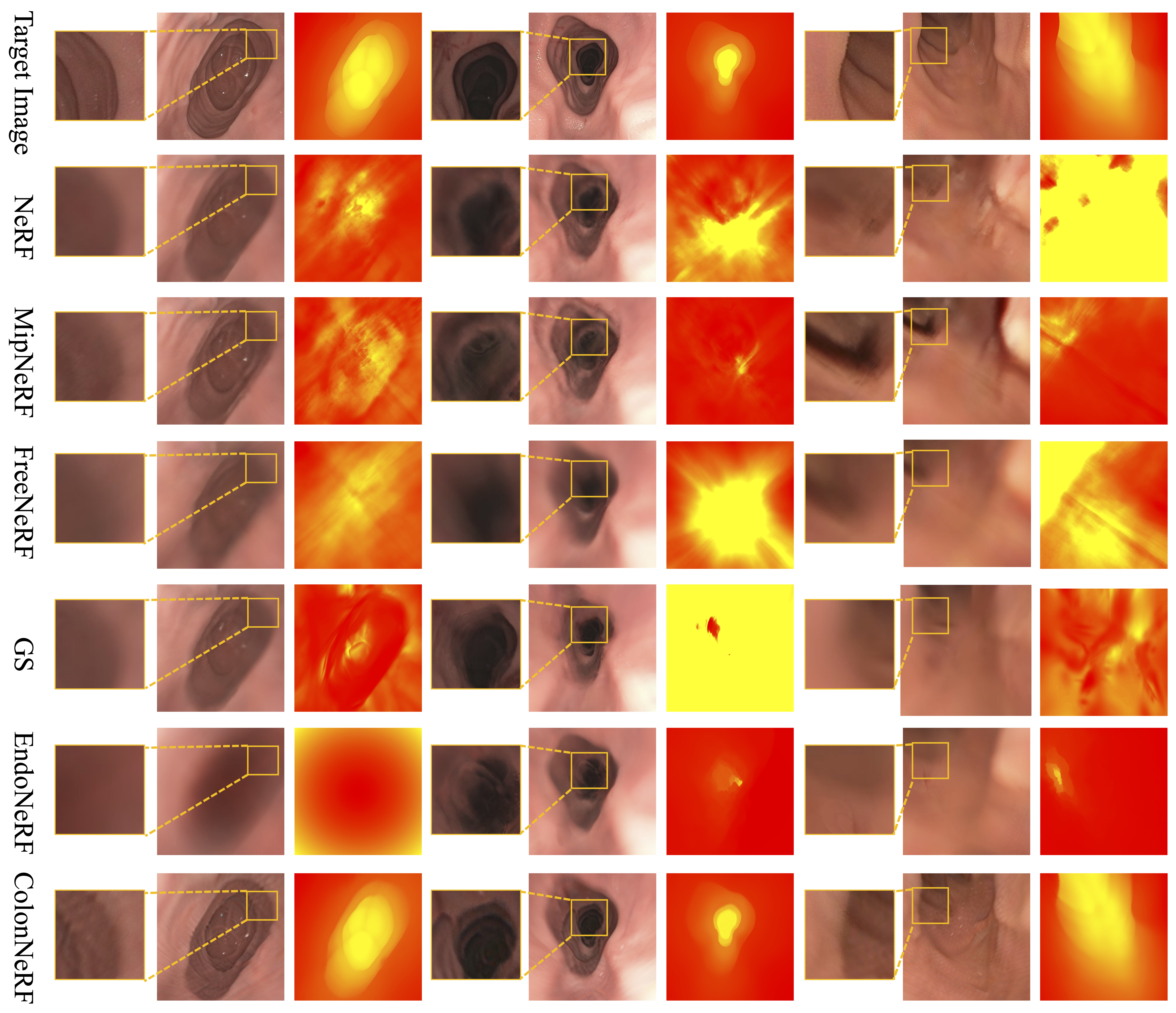ColonNeRF Additional Comparative Results